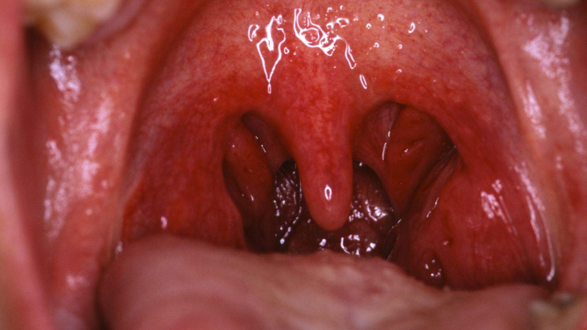 Inside View Of Mouth